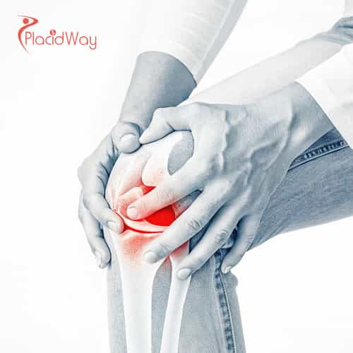 Tratamiento articular con células madre en Colombia: costos, clínicas y tasas de éxito